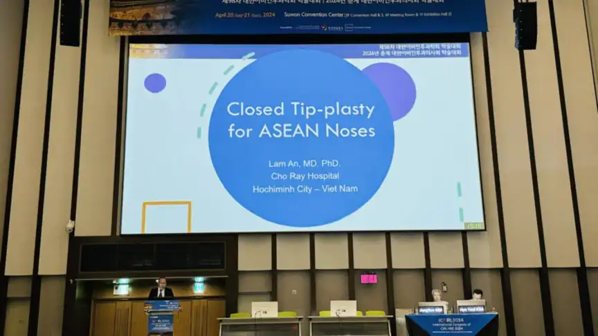 BS An trình bày báo cáo “Closed Tip-plasty for ASEAN Noses” tại hội nghị ICORL 2024